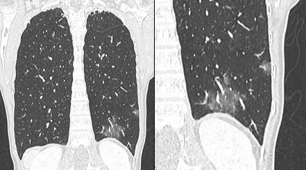 Covid 19 - figure 1