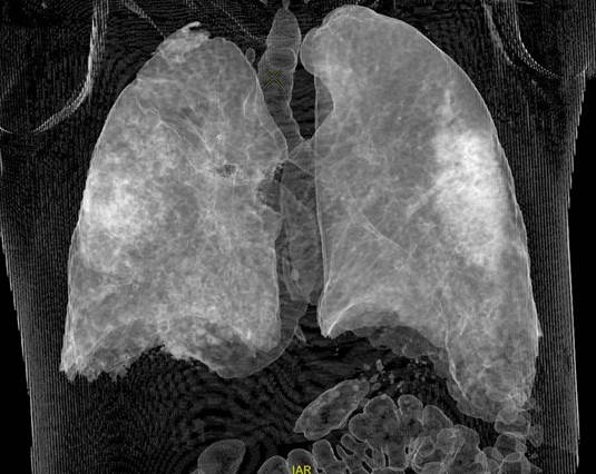 Covid 19 - figure 4