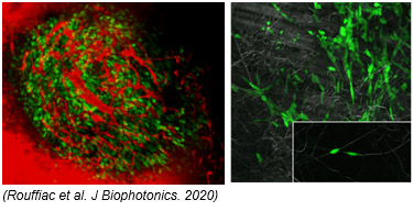 Imagerie de transfert clinique - cellules